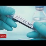 Coronavirus: medical staff struggle to get tested as govt says it’s passed 100,000 target – BBC News